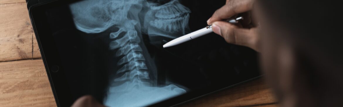 An X-Ray Result of a person's neck